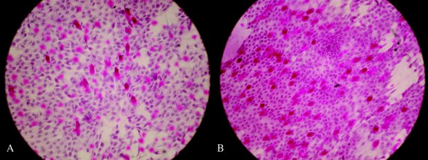 View OriginalDownload Slide