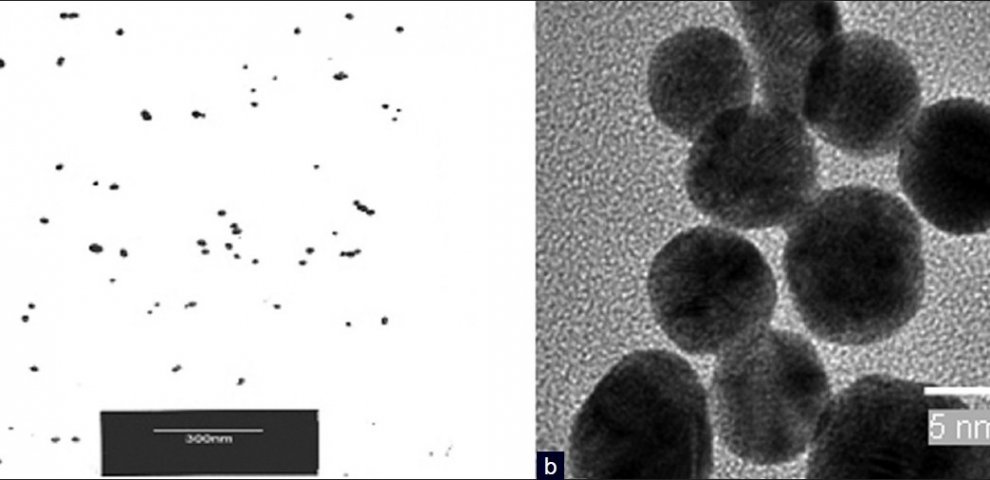 Nitric oxide nanoparticles