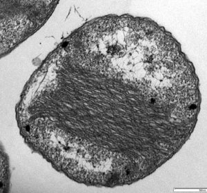 Ammonia oxidizing archaea
