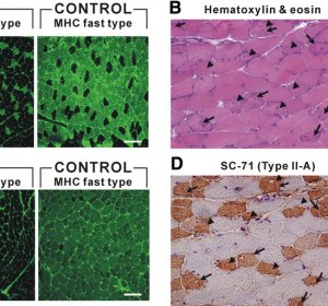 Fast Oxidative fibers