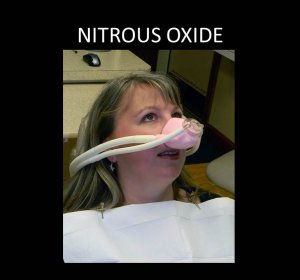 Laughing Gas (Nitrous Oxide)