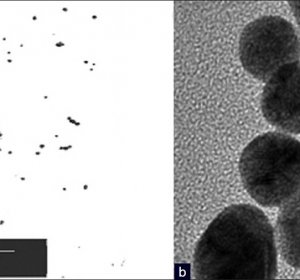 Nitric oxide nanoparticles